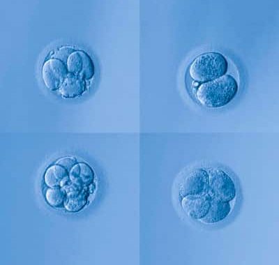 Fecundación in Vitro FIV Ginefiv España