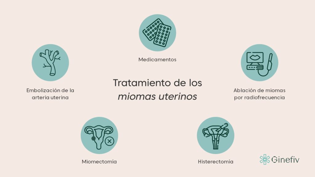 tratamiento miomas uterinos