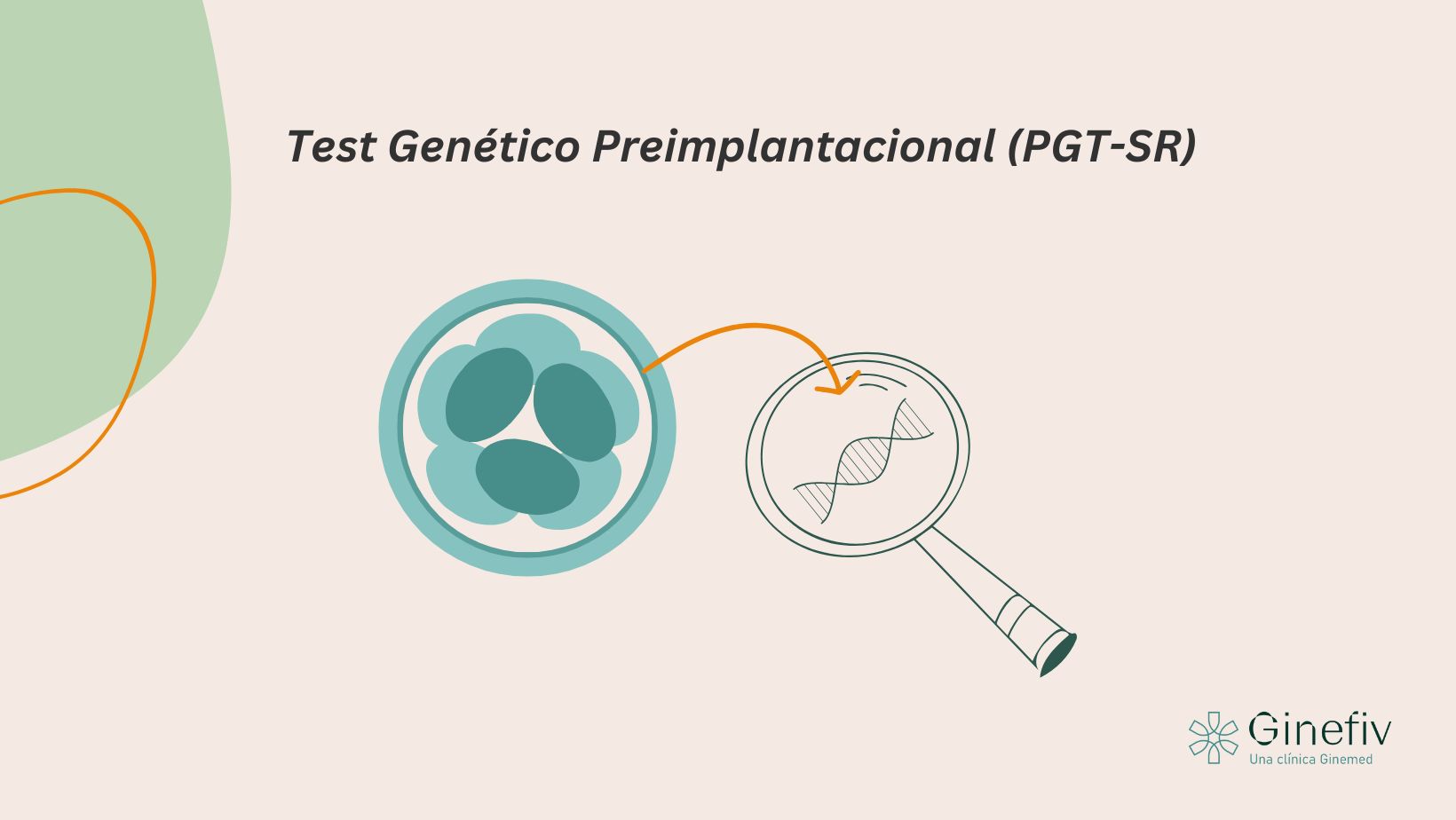 PGT-SR Ginefiv